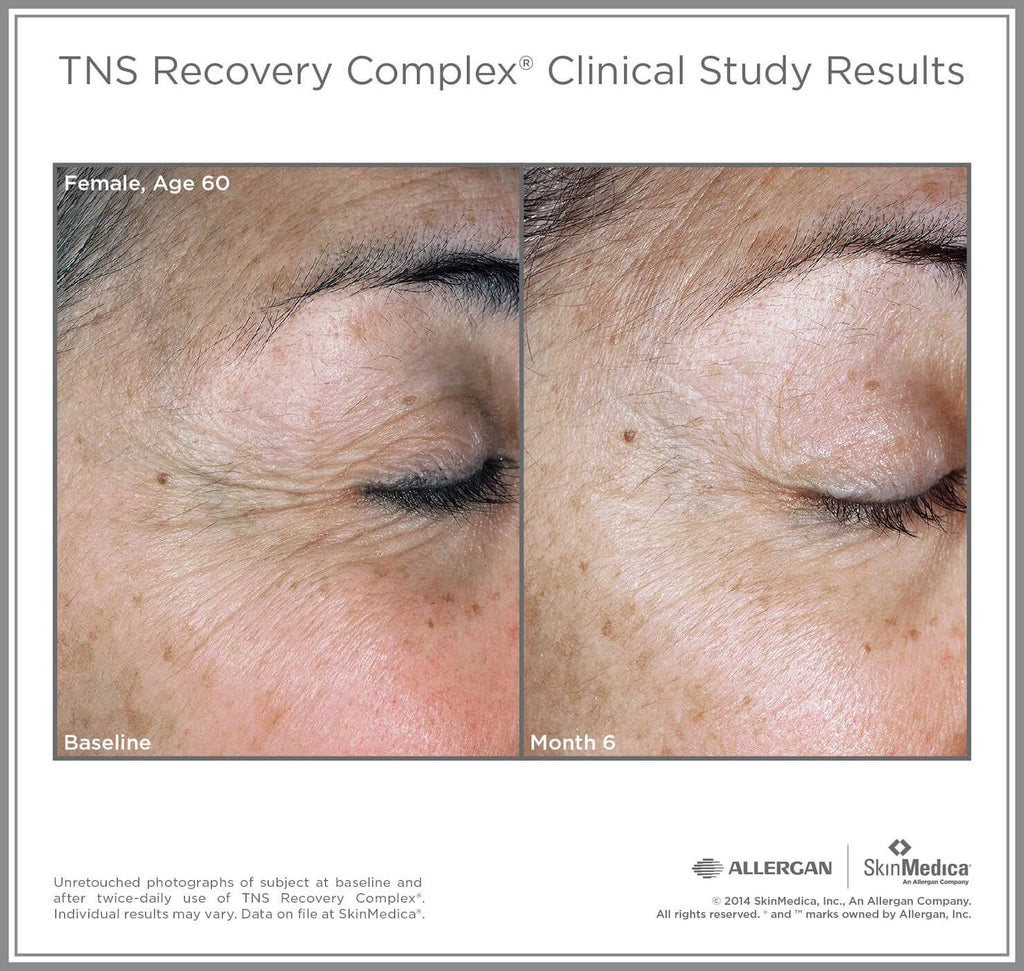 TNS Recovery Complex 0.63 oz Q85884