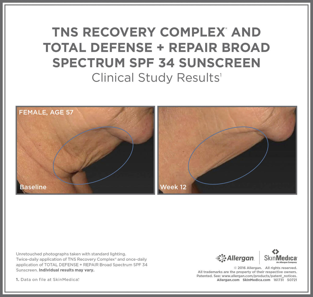 TNS Recovery Complex 0.63 oz Q85884